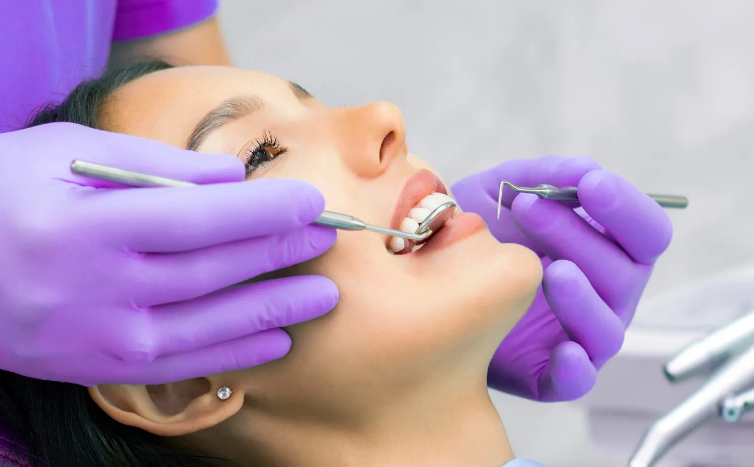 dental implant