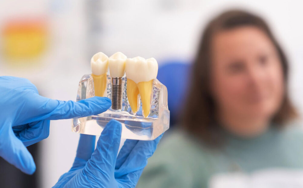 dental-implants