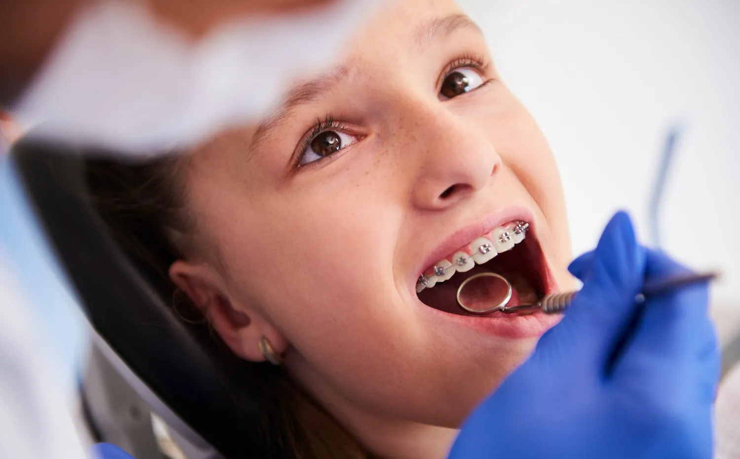 orthodontic braces