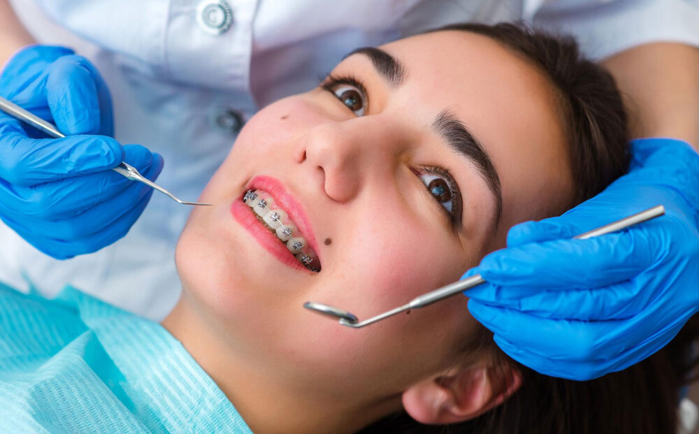 orthodontic-braces